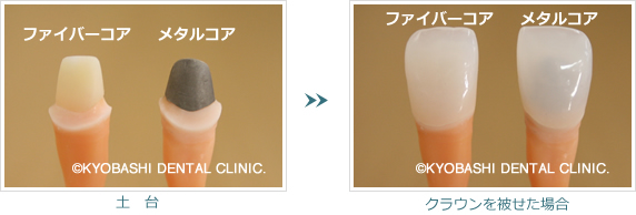 ファイバーコア